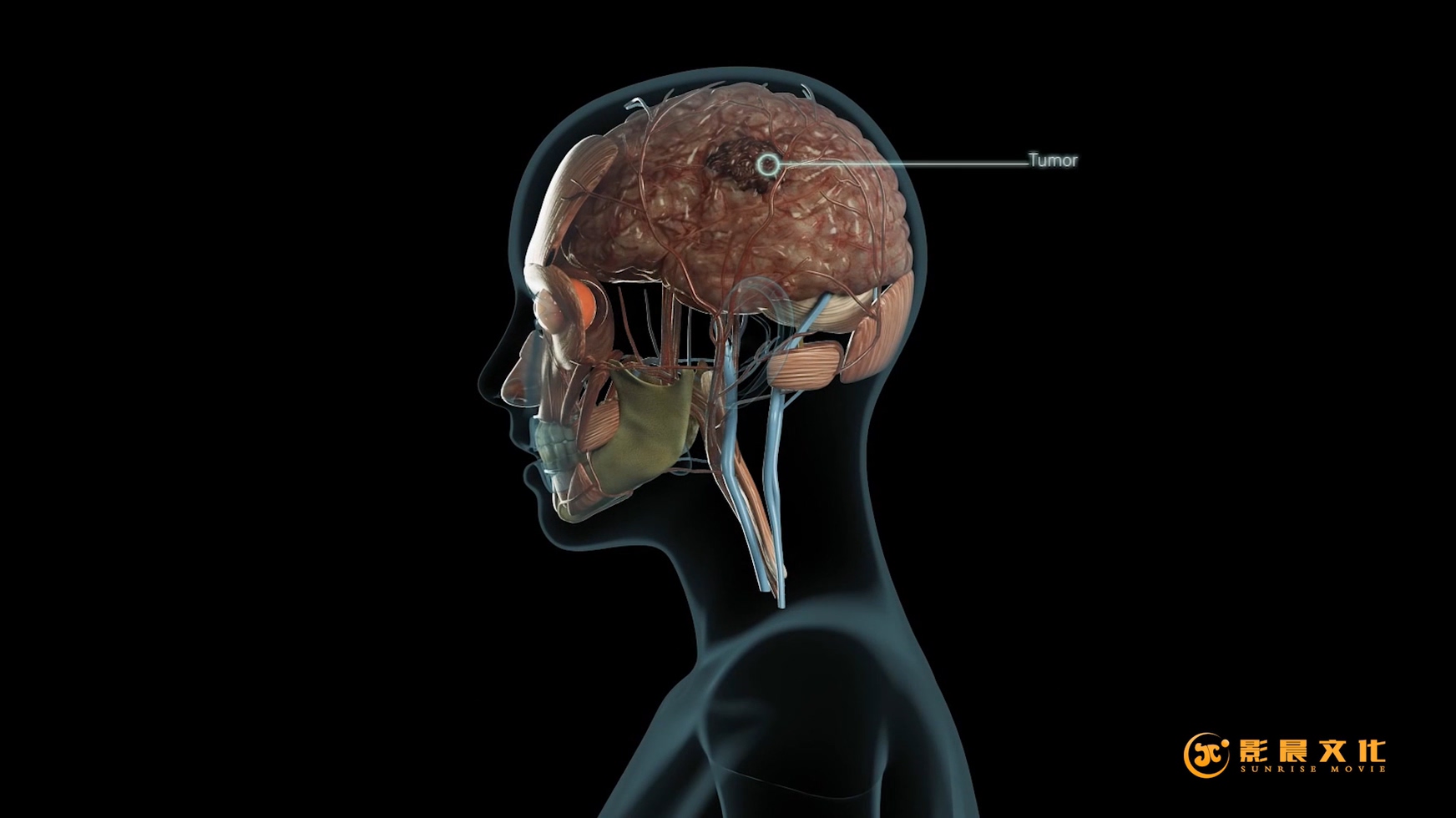 廣州醫(yī)學(xué)三維動(dòng)畫