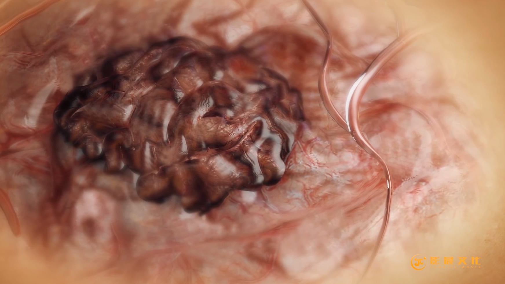 廣州醫(yī)學三維動畫