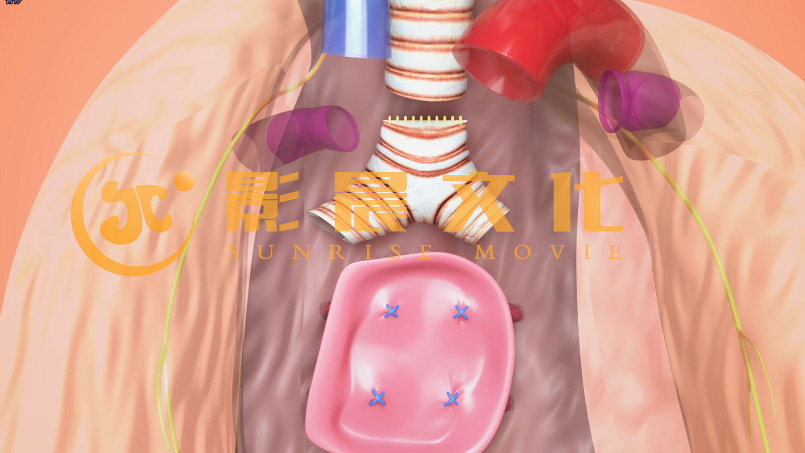 醫(yī)學三維動畫案例